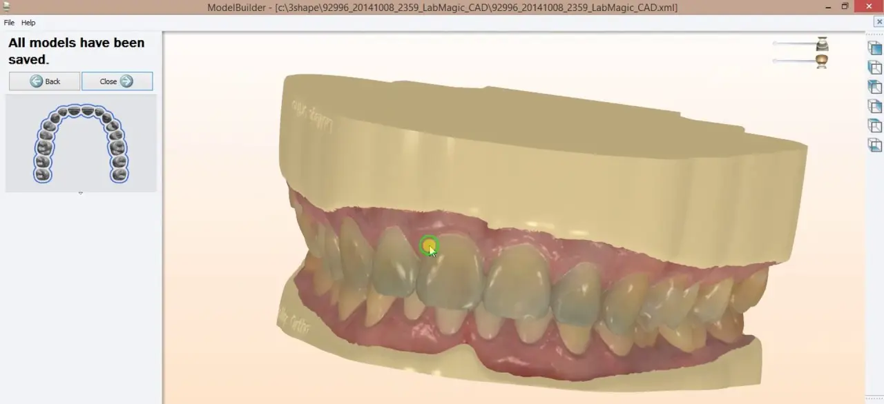 La Prothèse Dentaire Numérique : Une Évolution Dentaire